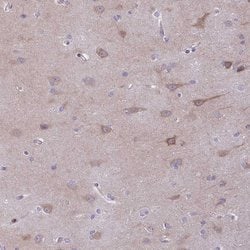 Invitrogen AdoHcyase 3 Polyclonal Antibody 100 &mu;L; Unconjugated:Antibodies,