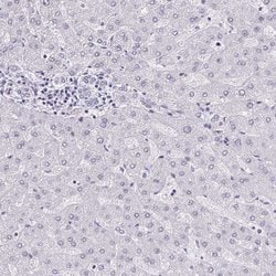 Invitrogen AdoHcyase 3 Polyclonal Antibody 100 &mu;L; Unconjugated:Antibodies,