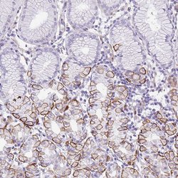 Invitrogen AdoHcyase 3 Polyclonal Antibody 100 &mu;L; Unconjugated:Antibodies,