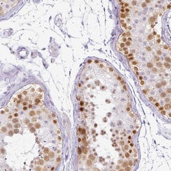 Invitrogen RBMY1F Polyclonal Antibody 100 &mu;L; Unconjugated:Antibodies,
