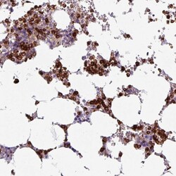 Invitrogen EXOSC5 Polyclonal Antibody 100 &mu;L; Unconjugated:Antibodies,