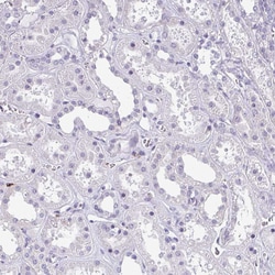 Invitrogen EXOSC5 Polyclonal Antibody 100 &mu;L; Unconjugated:Antibodies,