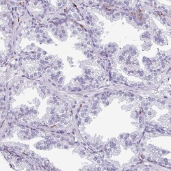 Invitrogen EXOSC5 Polyclonal Antibody 100 &mu;L; Unconjugated:Antibodies,