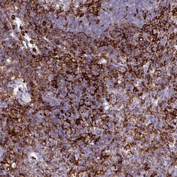 Invitrogen EXOSC5 Polyclonal Antibody 100 &mu;L; Unconjugated:Antibodies,