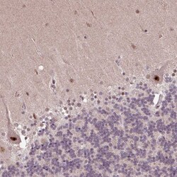 Invitrogen ZNF709 Polyclonal Antibody 100 &mu;L; Unconjugated:Antibodies,