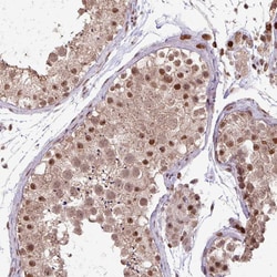 Invitrogen ZNF709 Polyclonal Antibody 100 &mu;L; Unconjugated:Antibodies,