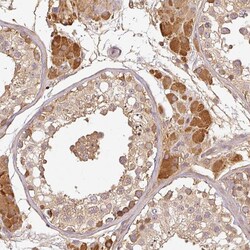 Invitrogen TCL1B Polyclonal Antibody 100 &mu;L; Unconjugated:Antibodies,