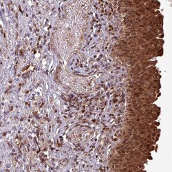 Invitrogen OR6B1 Polyclonal Antibody 100 &mu;L | Buy Online | Invitrogen&trade; | Fisher Scientific