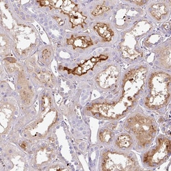 Invitrogen CTXN2 Polyclonal Antibody 100 &mu;L | Buy Online | Invitrogen&trade; | Fisher Scientific