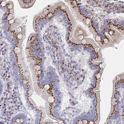Invitrogen MAN1A1 Polyclonal Antibody 100 &mu;L; Unconjugated:Antibodies,