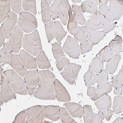 Invitrogen MAN1A1 Polyclonal Antibody 100 &mu;L; Unconjugated:Antibodies,