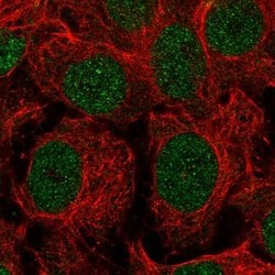 Invitrogen VPRBP Polyclonal Antibody 100 &mu;L; Unconjugated:Antibodies,