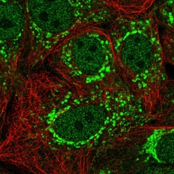 Invitrogen C3orf1 Polyclonal Antibody 100 &mu;L; Unconjugated:Antibodies,