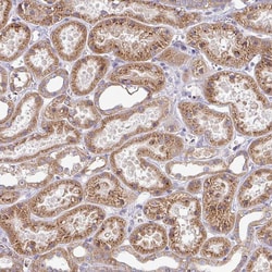 Invitrogen C3orf1 Polyclonal Antibody 100 &mu;L; Unconjugated:Antibodies,