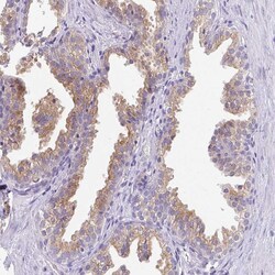 Invitrogen FAM177A1 Polyclonal Antibody 100 &mu;L | Buy Online | Invitrogen&trade; | Fisher Scientific