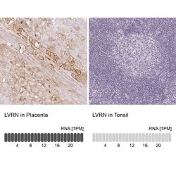 Invitrogen AQPEP Polyclonal Antibody 100 &mu;L; Unconjugated:Antibodies,