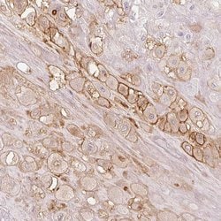 Invitrogen AQPEP Polyclonal Antibody 100 &mu;L; Unconjugated:Antibodies,
