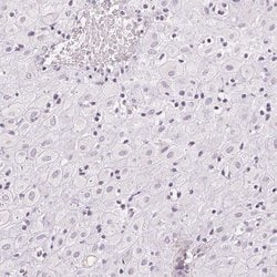 Invitrogen AQPEP Polyclonal Antibody 100 &mu;L; Unconjugated:Antibodies,