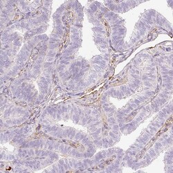 Invitrogen PR38B Polyclonal Antibody 100 &mu;L; Unconjugated:Antibodies,
