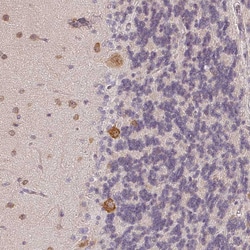 Invitrogen AGPAT4 Polyclonal Antibody 100 &mu;L; Unconjugated:Antibodies,