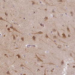 Invitrogen AGPAT4 Polyclonal Antibody 100 &mu;L; Unconjugated:Antibodies,