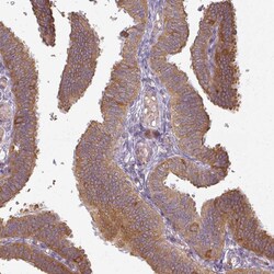 Invitrogen AGPAT4 Polyclonal Antibody 100 &mu;L; Unconjugated:Antibodies,