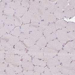 Invitrogen AGPAT4 Polyclonal Antibody 100 &mu;L; Unconjugated:Antibodies,