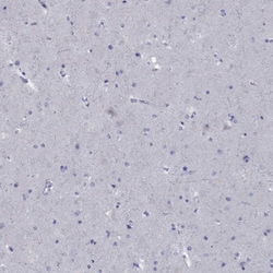 Invitrogen ABCB4 Polyclonal Antibody 100 &mu;L; Unconjugated:Antibodies,