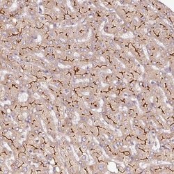 Invitrogen ABCB4 Polyclonal Antibody 100 &mu;L; Unconjugated:Antibodies,