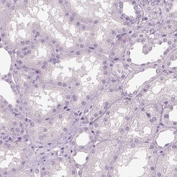 Invitrogen OTUD6A Polyclonal Antibody 100 &mu;L; Unconjugated:Antibodies,