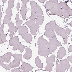 Invitrogen OTUD6A Polyclonal Antibody 100 &mu;L; Unconjugated:Antibodies,