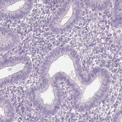 Invitrogen OTUD6A Polyclonal Antibody 100 &mu;L; Unconjugated:Antibodies,
