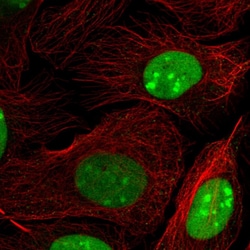 Invitrogen HMGB2 Polyclonal Antibody 100 &mu;L | Buy Online | Invitrogen&trade; | Fisher Scientific