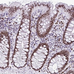 Invitrogen HMGB2 Polyclonal Antibody 100 &mu;L | Buy Online | Invitrogen&trade; | Fisher Scientific