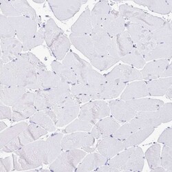 Invitrogen HMGB2 Polyclonal Antibody 100 &mu;L | Buy Online | Invitrogen&trade; | Fisher Scientific