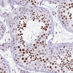 Invitrogen HMGB2 Polyclonal Antibody 100 &mu;L | Buy Online | Invitrogen&trade; | Fisher Scientific