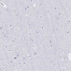 Invitrogen HMGB2 Polyclonal Antibody 100 &mu;L | Buy Online | Invitrogen&trade; | Fisher Scientific