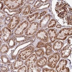 Invitrogen FAM47E Polyclonal Antibody 100 &mu;L | Buy Online | Invitrogen&trade; | Fisher Scientific