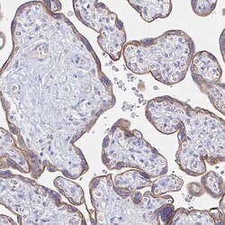 Invitrogen RhoV Polyclonal Antibody 100 &mu;L; Unconjugated:Antibodies,