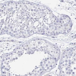 Invitrogen RhoV Polyclonal Antibody 100 &mu;L; Unconjugated:Antibodies,