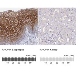 Invitrogen RhoV Polyclonal Antibody 100 &mu;L; Unconjugated:Antibodies,