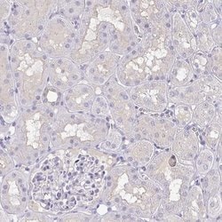 Invitrogen RhoV Polyclonal Antibody 100 &mu;L; Unconjugated:Antibodies,