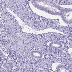 CST11 Polyclonal Antibody:Antibodies, Polyclonal