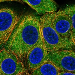 Invitrogen DESI1 Polyclonal Antibody 100 &mu;L; Unconjugated:Antibodies,