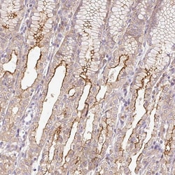 Invitrogen DESI1 Polyclonal Antibody 100 &mu;L; Unconjugated:Antibodies,