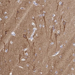 Invitrogen PPFIA4 Polyclonal Antibody 100 &mu;L; Unconjugated:Antibodies,