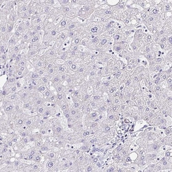 Invitrogen PPFIA4 Polyclonal Antibody 100 &mu;L; Unconjugated:Antibodies,