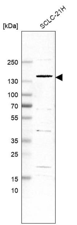Invitrogen PPFIA4 Polyclonal Antibody 100 &mu;L | Buy Online | Invitrogen&trade; | Fisher Scientific