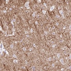 Invitrogen EMC4 Polyclonal Antibody 100 &mu;L | Buy Online | Invitrogen&trade; | Fisher Scientific
