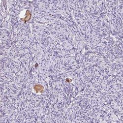 Invitrogen SNX31 Polyclonal Antibody 100 &mu;L; Unconjugated:Antibodies,